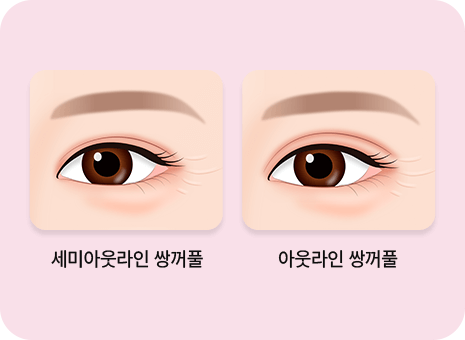 쌍커풀 라인 이미지